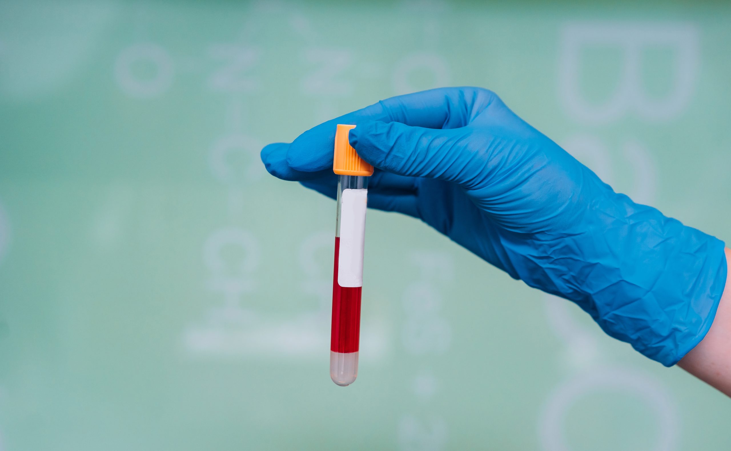 A rubber-gloved hand holds one test tube with the drug, close view
